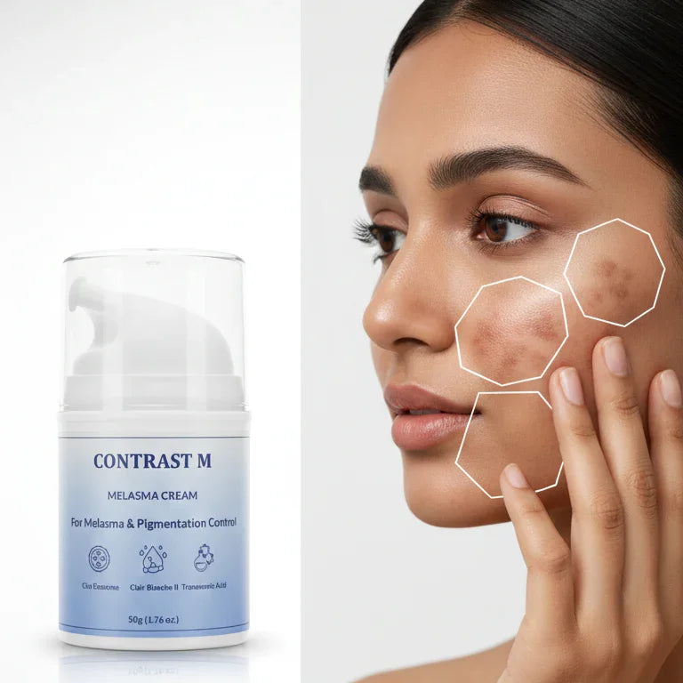 Contrast M melasma cream for pigmentation control shown next to woman with hyperpigmentation on cheek