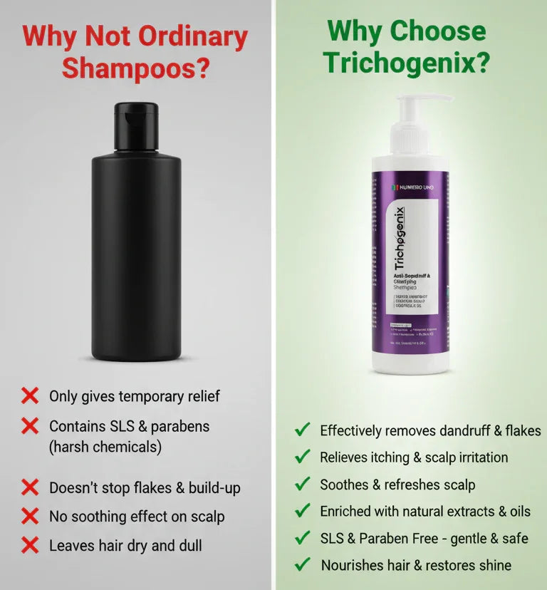 Trichogenix Dandruff Repair Shampoo | Anti-Dandruff, Itch Relief & Scalp Treatment